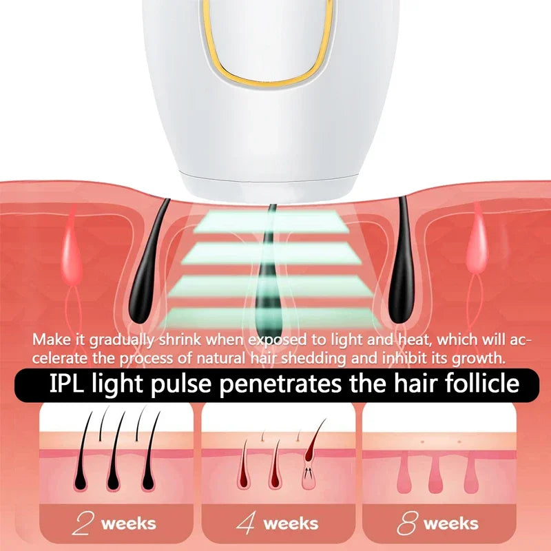 Épilateur laser IPL